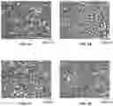 Fig. 02 - METHODS OF TREATMENT FOR KIDNEY DISEASE