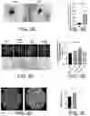 Fig. 07 - Compositions and Methods for Promoting Angiogenesis in the Eye