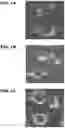 Fig. 02 - Use of collagen hydrolysate for improving endurance performance and for stimulating lipid catabolism