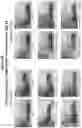 Fig. 28 - PEPTIDE IMMUNOGENS TARGETING INTERLEUKIN 6 (IL-6) AND FORMULATIONS THEREOF FOR IMMUNOTHERAPY OF DISEASES IMPACTED BY IL-6 DYSREGULATION