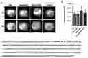 Fig. 26 - Gut bacteria derived microvesicles for vaccine delivery