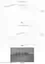 Fig. 03 - POLYETHYLENE GLYCOL CONJUGATED DRUG AND ITS PREPARATION METHOD AND USE