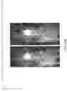Fig. 83 - PSMA-TARGETED NIR DYES AND THEIR USES