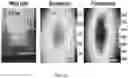 Fig. 07 - SENSITIVITY ADVANCES IN ULTRASOUND SWITCHABLE FLUORESCENCE SYSTEMS AND TECHNIQUES