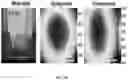 Fig. 08 - SENSITIVITY ADVANCES IN ULTRASOUND SWITCHABLE FLUORESCENCE SYSTEMS AND TECHNIQUES