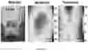 Fig. 10 - SENSITIVITY ADVANCES IN ULTRASOUND SWITCHABLE FLUORESCENCE SYSTEMS AND TECHNIQUES
