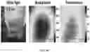 Fig. 11 - SENSITIVITY ADVANCES IN ULTRASOUND SWITCHABLE FLUORESCENCE SYSTEMS AND TECHNIQUES