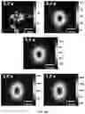 Fig. 23 - SENSITIVITY ADVANCES IN ULTRASOUND SWITCHABLE FLUORESCENCE SYSTEMS AND TECHNIQUES