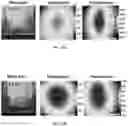 Fig. 26 - SENSITIVITY ADVANCES IN ULTRASOUND SWITCHABLE FLUORESCENCE SYSTEMS AND TECHNIQUES