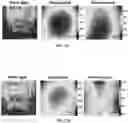 Fig. 27 - SENSITIVITY ADVANCES IN ULTRASOUND SWITCHABLE FLUORESCENCE SYSTEMS AND TECHNIQUES