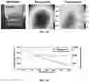 Fig. 28 - SENSITIVITY ADVANCES IN ULTRASOUND SWITCHABLE FLUORESCENCE SYSTEMS AND TECHNIQUES