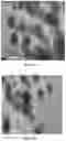 Fig. 42 - SENSITIVITY ADVANCES IN ULTRASOUND SWITCHABLE FLUORESCENCE SYSTEMS AND TECHNIQUES