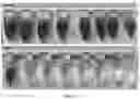 Fig. 48 - SENSITIVITY ADVANCES IN ULTRASOUND SWITCHABLE FLUORESCENCE SYSTEMS AND TECHNIQUES