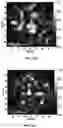Fig. 55 - SENSITIVITY ADVANCES IN ULTRASOUND SWITCHABLE FLUORESCENCE SYSTEMS AND TECHNIQUES