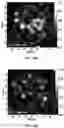 Fig. 56 - SENSITIVITY ADVANCES IN ULTRASOUND SWITCHABLE FLUORESCENCE SYSTEMS AND TECHNIQUES