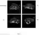 Fig. 03 - Macrocyclic Agents for Targeted Dual-Modality PET and MRI Imaging of Cancer
