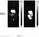 Fig. 06 - Macrocyclic Agents for Targeted Dual-Modality PET and MRI Imaging of Cancer