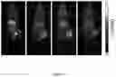 Fig. 07 - Macrocyclic Agents for Targeted Dual-Modality PET and MRI Imaging of Cancer