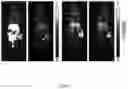 Fig. 08 - Macrocyclic Agents for Targeted Dual-Modality PET and MRI Imaging of Cancer