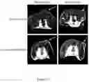 Fig. 14 - Macrocyclic Agents for Targeted Dual-Modality PET and MRI Imaging of Cancer