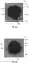 Fig. 04 - Heat Treating to Improve Synthetic Leaflet Motion and Coaptation