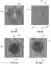 Fig. 10 - Heat Treating to Improve Synthetic Leaflet Motion and Coaptation