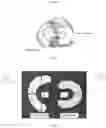Fig. 02 - COLLAGEN-BASED MENISCUS IMPLANTS