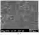 Fig. 03 - COLLAGEN-BASED MENISCUS IMPLANTS