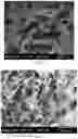 Fig. 04 - COLLAGEN-BASED MENISCUS IMPLANTS
