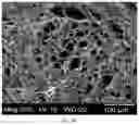 Fig. 05 - COLLAGEN-BASED MENISCUS IMPLANTS
