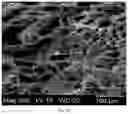 Fig. 06 - COLLAGEN-BASED MENISCUS IMPLANTS