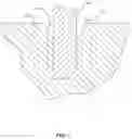 Fig. 02 - FLUORAPATITE COATED IMPLANTS AND RELATED METHODS REGARDING FEDERALLY SPONSORED RESEARCH