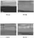 Fig. 11 - FLUORAPATITE COATED IMPLANTS AND RELATED METHODS REGARDING FEDERALLY SPONSORED RESEARCH
