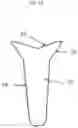 Fig. 21 - Demineralized bone fiber implant compositions and methods for rotator cuff and ACL repair
