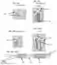 Fig. 23 - Demineralized bone fiber implant compositions and methods for rotator cuff and ACL repair