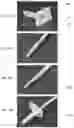 Fig. 28 - Demineralized bone fiber implant compositions and methods for rotator cuff and ACL repair