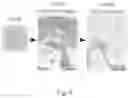 Fig. 09 - Engineering mechanically functional human cartilage and method of making same