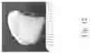 Fig. 13 - Engineering mechanically functional human cartilage and method of making same
