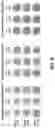 Fig. 05 - METHODS AND COMPOSITIONS FOR PROTECTION OF BIOPROSTHETIC HEART VALVE TISSUE FROM GLYCATION AND ASSOCIATED PROTEIN INCORPORATION