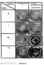 Fig. 09 - BONE-LIKE PROSTHETIC IMPLANTS