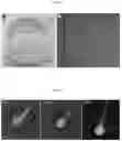 Fig. 03 - BIODEGRADABLE SCAFFOLD FOR HAIR GROWTH AND METHODS OF USE THEREFOR