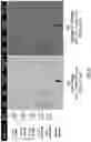 Fig. 08 - X-RAY AND MRI VISIBLE SHAPE MEMORY POLYMER BIOPSY SEALING DEVICE