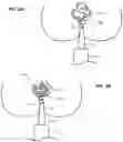 Fig. 03 - Rectal Irrigation Apparatus