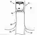Fig. 01 - Seal assembly for circular stapling instrument