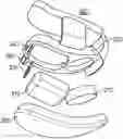 Fig. 01 - WIRELESS GUM OR TISSUE NUMBING DEVICE