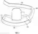 Fig. 02 - WIRELESS GUM OR TISSUE NUMBING DEVICE