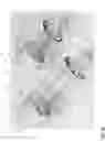 Fig. 04 - INHALABLE MEDICAL AEROSOL DISPENSING SYSTEM
