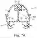 Fig. 09 - Cushion for a respiratory mask assembly