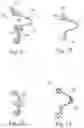 Fig. 18 - Cushion for a respiratory mask assembly