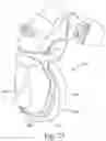 Fig. 21 - Cushion for a respiratory mask assembly